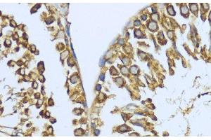Immunohistochemistry of paraffin-embedded Rat testis using HSP90AA1 Polyclonal Antibody at dilution of 1:200 (40x lens). (HSP90AA1 Antikörper)