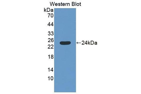 SAT1 Antikörper  (AA 1-171)
