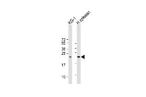 All lanes : Anti- LIF Antibody (Center) at 1:1000 dilution Lane 1: KG-1 whole cell lysate Lane 2:Human spleen whole cell lysate Lysates/proteins at 20 μg per lane. (LIF Antikörper  (AA 72-101))