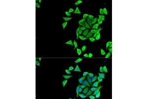 Immunofluorescence analysis of U2OS cells using KCNN3 Polyclonal Antibody (KCNN3 Antikörper)