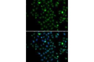 Immunofluorescence analysis of MCF7 cell using LMO4 antibody. (LMO4 Antikörper)