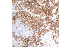 Immunohistochemistry (IHC) image for anti-CD27 Molecule (CD27) (AA 21-187) antibody (ABIN7455146)