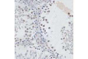 Immunohistochemistry of paraffin-embedded rat testis using USP7/HAUSP antibody (ABIN6132280, ABIN6150032, ABIN6150034 and ABIN6217614) at dilution of 1:100 (40x lens). (USP7 Antikörper  (AA 206-1102))