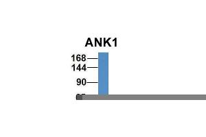 Host:  Rabbit  Target Name:  ANK1  Sample Type:  Human Fetal Liver  Antibody Dilution:  1.