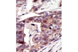 Image no. 2 for anti-Palmitoyl-Protein Thioesterase 1 (PPT1) (N-Term) antibody (ABIN357783) (PPT1 Antikörper  (N-Term))