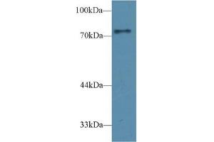 Detection of CD2AP in Rat Cerebrum lysate using Polyclonal Antibody to CD2 Associated Protein (CD2AP) (CD2AP Antikörper  (AA 368-623))