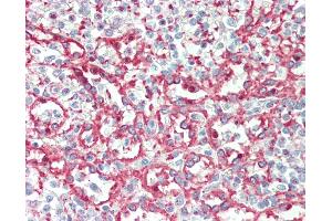 Anti-ITGA2B / CD41 antibody IHC staining of human spleen. (Integrin Alpha2b Antikörper  (AA 122-171))