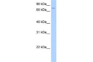WB Suggested Anti-SV2A Antibody Titration:  0. (SV2A Antikörper  (Middle Region))