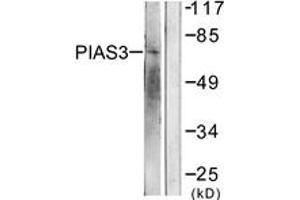 Western blot analysis of extracts from 293 cells, treated with UV 5', using PIAS3 Antibody.