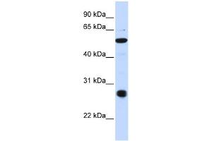 WB Suggested Anti-C6orf113 Antibody Titration:  0. (ZUFSP Antikörper  (C-Term))