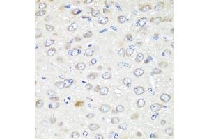 Immunohistochemistry of paraffin-embedded rat brain using G antibody (ABIN6129967, ABIN6140880, ABIN6140881 and ABIN6223736) at dilution of 1:200 (40x lens). (GABARAPL2 Antikörper  (AA 1-117))