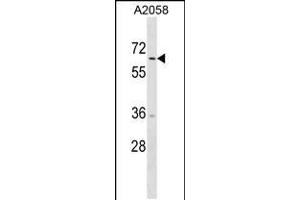 Western blot analysis in A2058 cell line lysates (35ug/lane). (TRIM35 Antikörper  (C-Term))