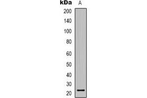 Western blot analysis of TCEAL6 expression in COLO205 (A) whole cell lysates. (TCEAL6 Antikörper)