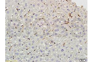 Immunohistochemistry (IHC) image for anti-Fc Fragment of IgG, Low Affinity IIb, Receptor (CD32) (FCGR2B) (pTyr292) antibody (ABIN761411)