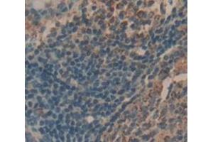 IHC-P analysis of Human Tissue, with DAB staining. (IL-21 Antikörper  (AA 23-155))