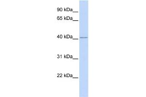WB Suggested Anti-RING1 Antibody Titration:  0. (RING1 Antikörper  (Middle Region))