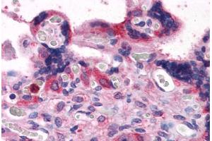 Human Placenta: Formalin-Fixed, Paraffin-Embedded (FFPE) (BAG3 Antikörper  (AA 563-575))
