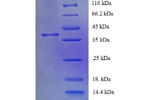 SDS-PAGE (SDS) image for Corticotropin Releasing Hormone Receptor 1 (CRHR1) (AA 24-121) protein (GST tag) (ABIN5709325) (CRHR1 Protein (AA 24-121) (GST tag))