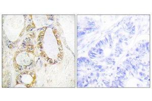 Immunohistochemistry (IHC) image for anti-Mucin 13, Cell Surface Associated (MUC13) (C-Term) antibody (ABIN1849970) (MUC13 Antikörper  (C-Term))