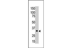 The MAGEA6 polyclonal antibody  is used in Western blot to detect MAGEA6 in A-549 cell lysate. (MAGEA6 Antikörper  (C-Term))