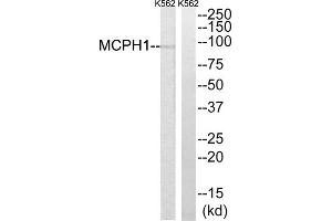 Western blot analysis of extracts from K562 cells, using MCPH1 antibody. (MCPH1 Antikörper  (N-Term))