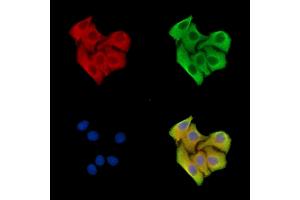 ABIN7096474 and ABIN7100538 staining Hela cells by IF/ICC. (PEMT Antikörper)