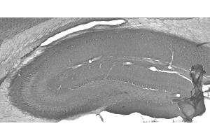 Adult rat hippocampus immunohistochemistry. (HSPA9 Antikörper  (AA 551-766))