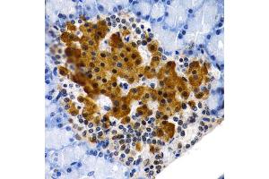 Immunohistochemistry of paraffin-embedded rat pancreas using MT2A antibody (ABIN1873764) at dilution of 1:200 (40x lens). (MT2A Antikörper)