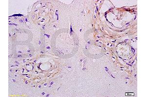 Formalin-fixed and paraffin embedded human placenta tissue labeled with Anti-Collagen III Polyclonal Antibody, Unconjugated (ABIN730168) at 1:200, followed by conjugation to the secondary antibody and DAB staining (COL3 Antikörper  (AA 801-900))