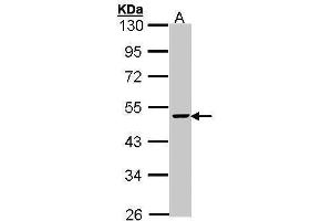 WB Image Sample (30 ug of whole cell lysate) A: Hep G2 , 10% SDS PAGE antibody diluted at 1:1000 (FEN1 Antikörper)