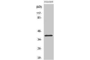 Western Blotting (WB) image for anti-Ribonucleotide Reductase M2 B (TP53 Inducible) (RRM2B) (Internal Region) antibody (ABIN3176737) (RRM2B Antikörper  (Internal Region))