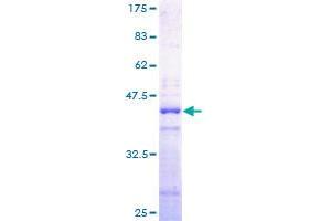 Image no. 1 for Histone Cluster 2, H2aa3 (HIST2H2AA3) (AA 1-130) protein (GST tag) (ABIN1306704) (HIST2H2AA3 Protein (AA 1-130) (GST tag))
