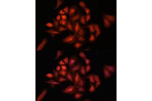 Immunofluorescence analysis of U-2 OS cells using ST antibody (ABIN6129464, ABIN6148550, ABIN6148551 and ABIN6222848) at dilution of 1:100. (STAM2 Antikörper  (AA 376-525))