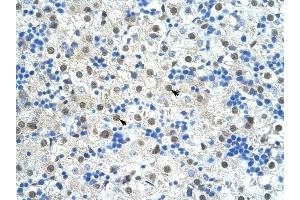 SF3B1 antibody was used for immunohistochemistry at a concentration of 4-8 ug/ml to stain Hepatocytes (arrows) in Human Liver. (SF3B1 Antikörper  (N-Term))
