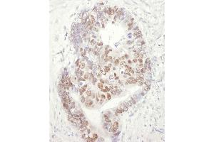 Immunohistochemistry (IHC) image for anti-Minichromosome Maintenance Complex Component 3 (MCM3) (AA 500-550) antibody (ABIN7449378)