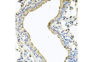 Immunohistochemistry of paraffin-embedded mouse lung using CHCHD3 antibody (ABIN5995784) at dilution of 1/100 (40x lens). (CHCHD3 Antikörper)