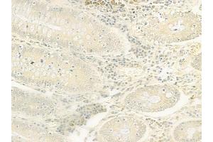 ABIN6262946 and ABIN6277777 at 1/100 staining human normal colon tissue by IHC-P.