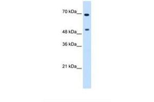 Image no. 1 for anti-Myc Proto-Oncogene protein (MYC) (N-Term) antibody (ABIN6737689)