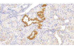 Immunohistochemistry (IHC) image for anti-Wingless-Type MMTV Integration Site Family, Member 2B (WNT2B) (AA 62-391) antibody (ABIN7444151)