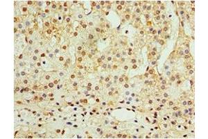 Immunohistochemistry of paraffin-embedded human adrenal gland tissue using ABIN7144558 at dilution of 1:100 (ADAP1 Antikörper  (AA 1-374))