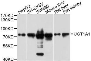 Western blot analysis of extracts of various cell lines, using UGT1A1 antibody. (UGT1A1 Antikörper  (AA 1-200))