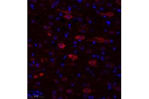 Immunofluorescence of paraffin embedded rat corpus striatum using TTC33 (ABIN7075871) at dilution of 1: 650 (300x lens) (TTC33 Antikörper)