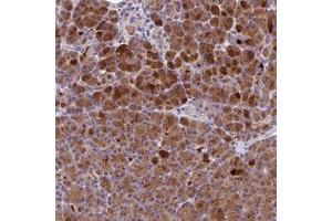Immunohistochemical staining of human pancreas with PZP polyclonal antibody  shows strong cytoplasmic positivity in exocrine glandular cells at 1:10-1:20 dilution. (PZP Antikörper)