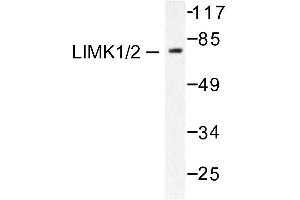 Image no. 1 for anti-LIM Domain Kinase 1 (LIMK1) antibody (ABIN265508) (LIM Domain Kinase 1 Antikörper)