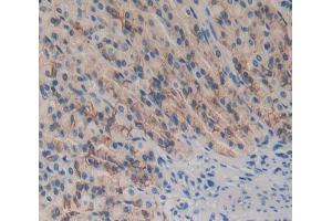 Used in DAB staining on fromalin fixed paraffin- embedded Kidney tissue (DOK7 Antikörper  (AA 63-320))