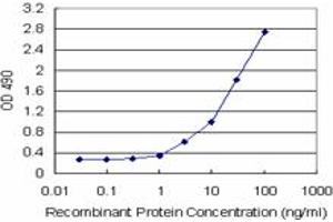 Sandwich ELISA detection sensitivity ranging from 1 ng/mL to 100 ng/mL. (TYMS (Human) Matched Antibody Pair)