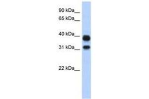 Image no. 1 for anti-Chitinase, Acidic (CHIA) (N-Term) antibody (ABIN6743114) (CHIA Antikörper  (N-Term))