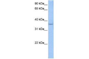 ACPT antibody used at 0.