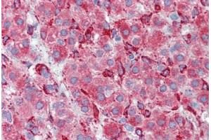 Human Adrenal (formalin-fixed, paraffin-embedded) stained with SERPINH1 antibody ABIN462363 followed by biotinylated anti-mouse IgG secondary antibody ABIN481714, alkaline phosphatase-streptavidin and chromogen.