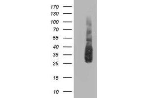 Western Blotting (WB) image for anti-ATG3 Autophagy Related 3 (ATG3) antibody (ABIN1496761)
